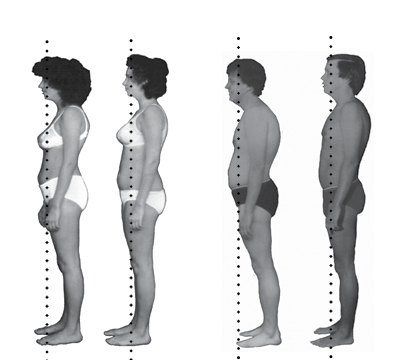 Rolfing Before and After Pics